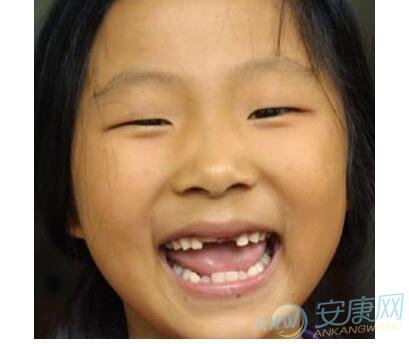 梦见小孩长牙齿有着怎样的好坏预示？