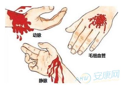 [梦见自己割手腕]正确解读梦见自己手腕流血的象征含义